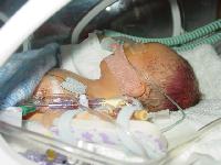 Massimo paralysed in NNU