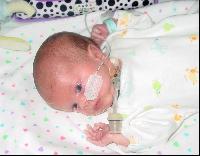 Max no cpap